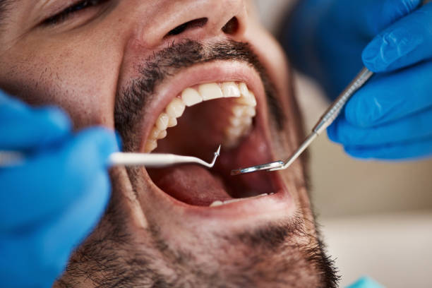 Emergency Dental Services in North Randall, OH